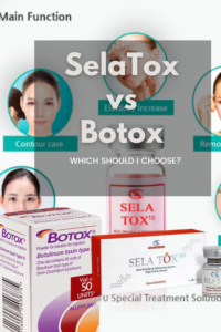 Sela Tox Vs Botox